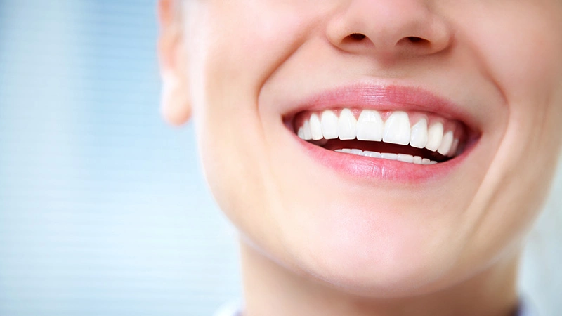 لاک سفید کننده دندان - تصویر شاخص